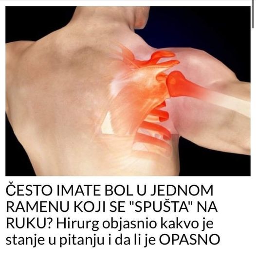 ČESTO IMATE B0L U JEDNOM RAMENU KOJI SE “SPUŠTA” NA RUKU? Hirurg objasnio kakvo je stanje u pitanju i da li je OPASN0